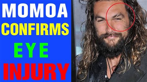 JASON MOMOA CONFIRMS EYE INJURY CAUSED BY AMBER …