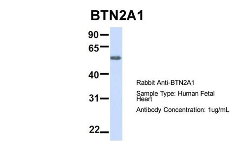 JCAD Antibody - N-terminal region (ARP66839_P050)