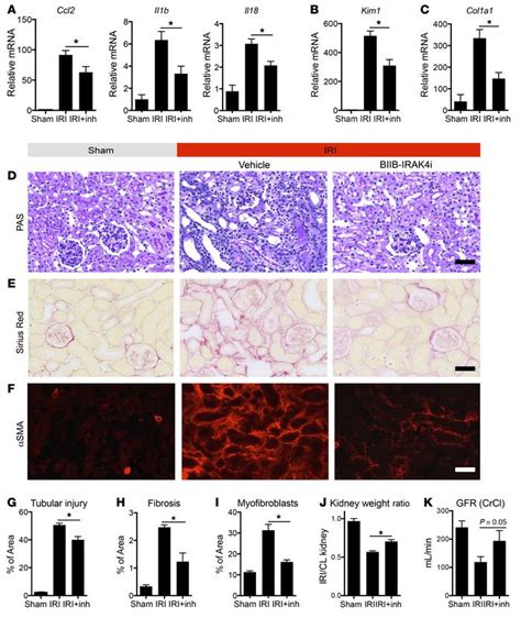 JCI - Pericyte MyD88 and IRAK4 control inflammatory and fibrotic ...