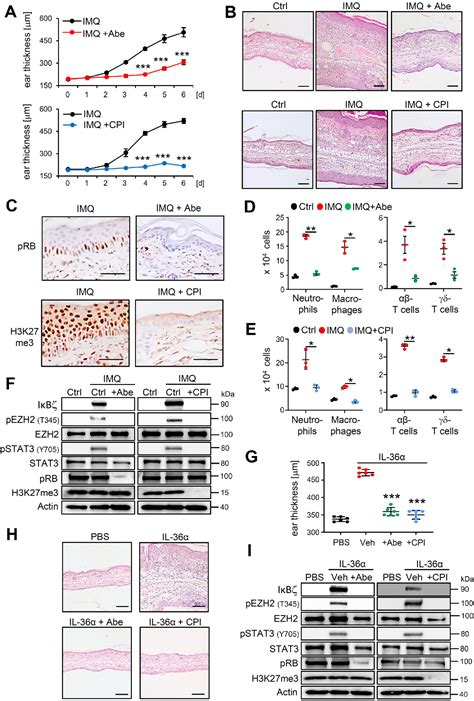 JCI - The CDK4/6-EZH2 pathway is a potential therapeutic target …