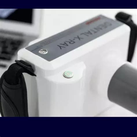 Jual Dental Xray Murah - Harga Terbaru Maret 2026 - wintechmobiles.com