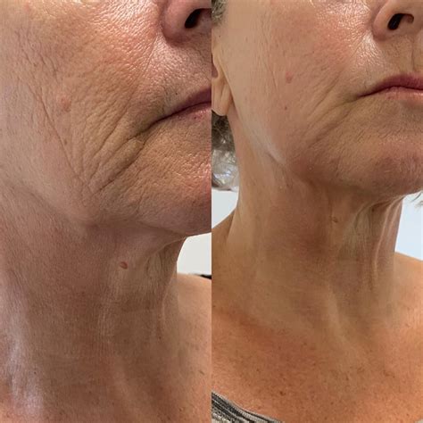 Ja.Lift Onlyfans Leaked XxX 🍌