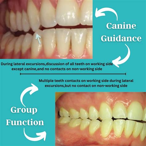 Jaw problems and headaches Oral Health Foundation