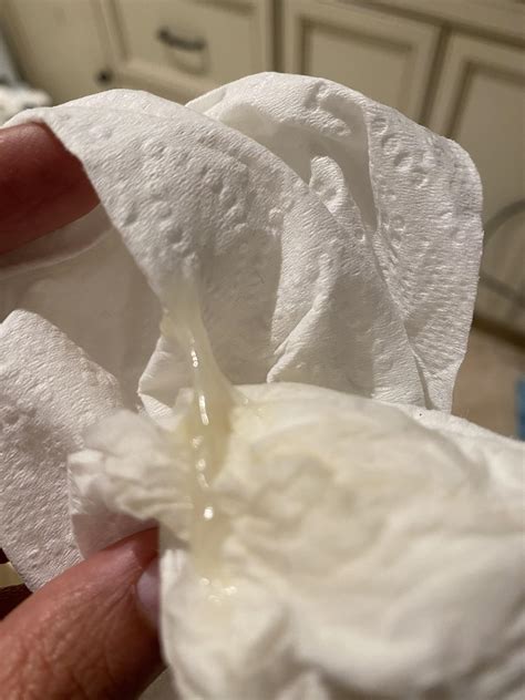 Jelly like discharge 1st Pregnancy Forums What to Expect