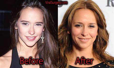 Jennifer love hewitt plastic surgery. Sep 7, 2023 · Jennifer Love Hewitt Claps Back at Plastic Surgery Speculation With Hilarious Filters. The 'I Know What You Did Last Summer' actress posted a new series of selfies calling out her critics who said ... 