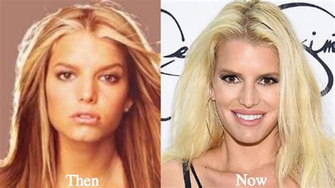 Jessica simpson nose. “Looking at the shadows along her nose, it is very probable she has undergone a nose job,” Beverly Hills plastic surgeon Dr. Payman Simoni told the magazine. Take a look at … 