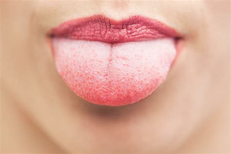– Plikova na jeziku se možete uspešno rešiti bosiljkom! Bosiljak uklanja simptome pola i zapaljenja. Bosiljak koristite tako što ga žvaćite 2 puta dnevno 3-4 dana, a nakon žvakanja, usta isperite toplom vodom. Prevencija nastanka plikova na jeziku. Ukoliko imate slabiji imuni sistem, to će se često rezultovati pojavom plikova na jeziku.. 