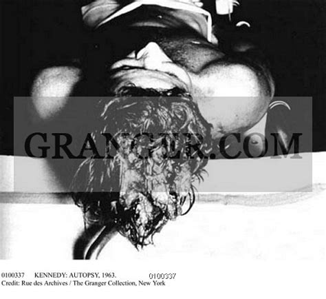 Jfk autopsy photos. Crucial Missing JFK Autopsy Photo Has Been Found, But Part Of It Is Missing 