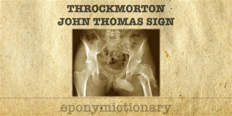 John Thomas Video Tongren