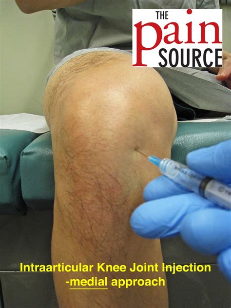 Jul 26, 2021 ... SI Joint Injection procedure is described by Dr. Andrew McNeil of Peninsula Pain Clinic. A sacroiliac joint injections (SI) are injections .... 