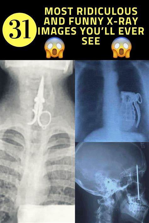 Joke x ray. X-ray jokes and x-ray puns are timeless. There’s just something funny about getting scanned by a device that can see right through you. It opens up so many … 