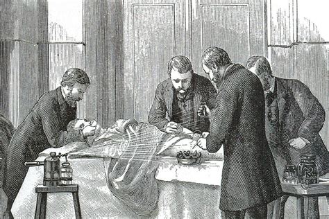 Joseph lister's erste veröffentlichung über antiseptische wundbehandlung (1867, 1868, 1869). - Flvs world history module 8 study guide.