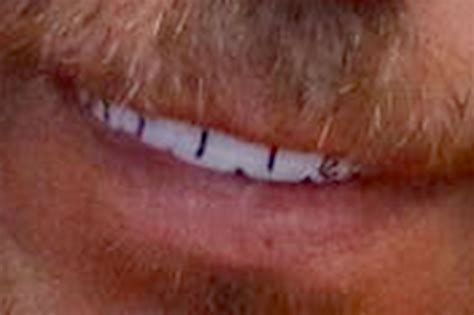 Joseph zieler teeth. Sixty-one-year-old Joseph Zieler was trying to appeal his death sentence 