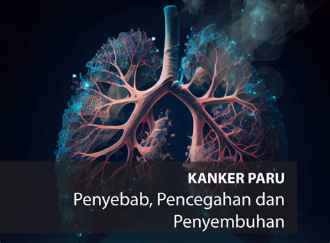 KANKER PARU - Kementerian Kesehatan Republik Indonesia - muktibox.com