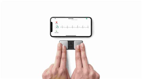 KardiaMobile for detecting atrial fibrillation | Guidance | NICE - coolestguyplanet.net