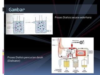 Kimia dialisis | PPTX - SlideShare - wintechmobiles.com
