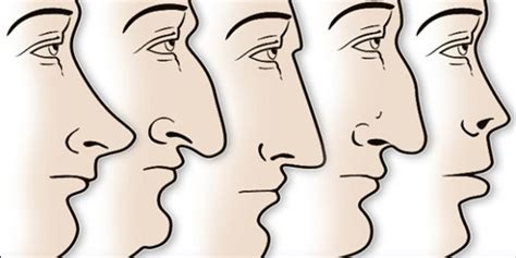 Karakteristik burun. 