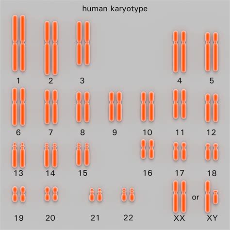 Karyotype disorders.  and Canada.  The karyotype can help identify abnormaliti...