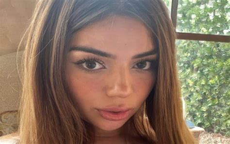 | Bookmark A woman who suffered devastating injuries after crashing head-first through a car window has shared how joining OnlyFans helped her to "reshape" her ….