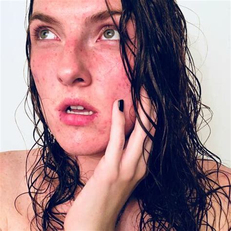 Kelly nixe
