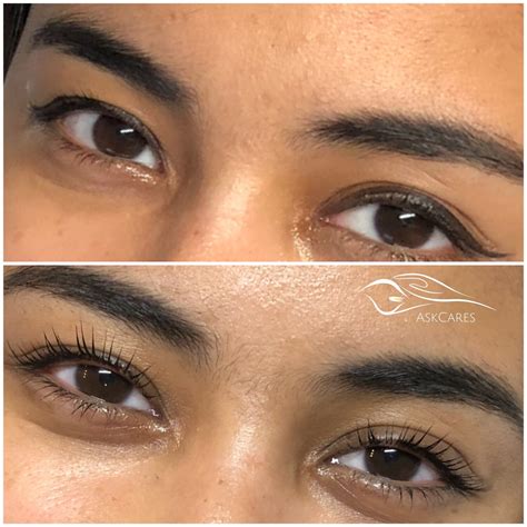 Keratin Eyelash Lift — AskCares