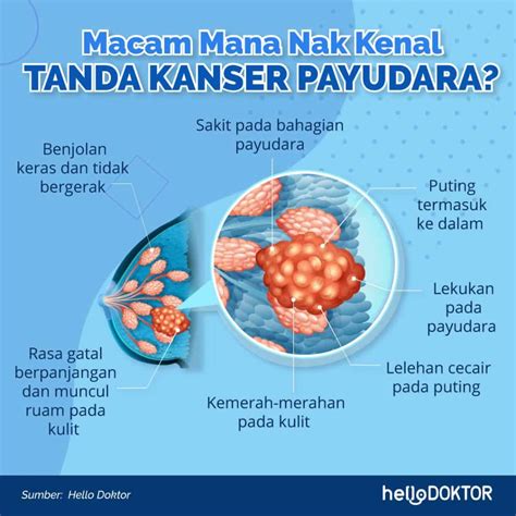 Jual produk aksesoris pagar besi termurah dan