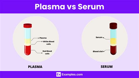 Key Differences Between Plasma & LED TVs MantelMount