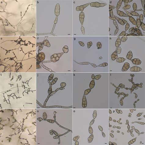 Key Identification Of Alternaria