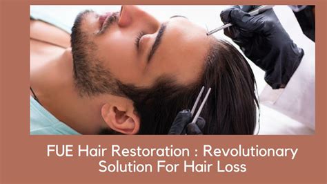 Keystone Hair Replacement: The Revolutionary Solution to Balding