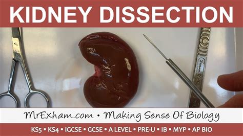 Kidney Dissection Method