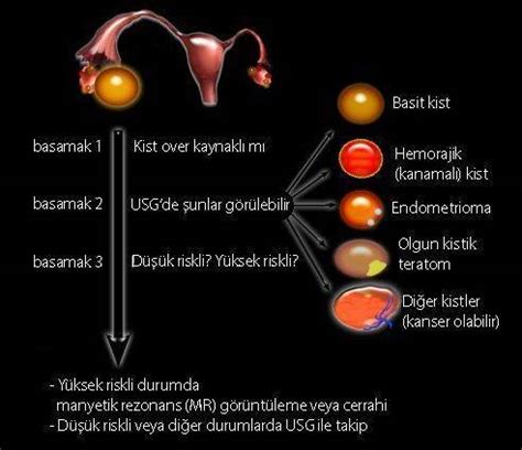 Kist Ve Tümör Aynı Mı – .