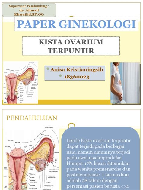 Kista Ovarium: Penyebab, Gejala, Diagnosis, & Pengobatan