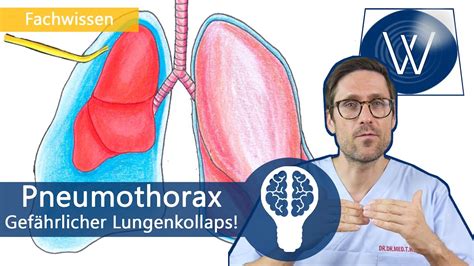 Klinische erfahrungen in behandlung mittels ku nstlichen pneumothorax. - Manuale di servizio citroen berlingo xtr 2011.