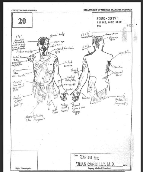 Kobe bryant death sketches. Things To Know About Kobe bryant death sketches. 