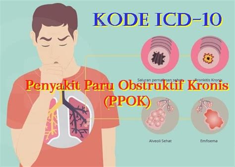 Kode Icd 10 Ca Paru