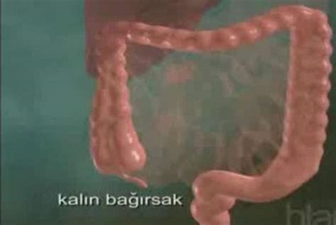 Kolon kanserinde erken tanı önemli Hukuki Haber.