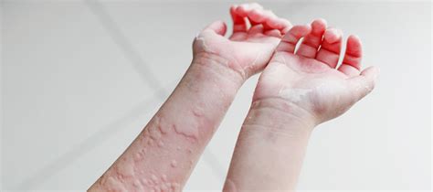 Kurdesen Halı ve Koltuk Yıkama