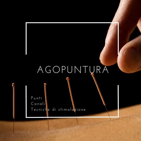 L'agopuntura per fibromialgia ha semplificato una guida illustrata. - Ar med innehall: en studiebok for alla aldrar.