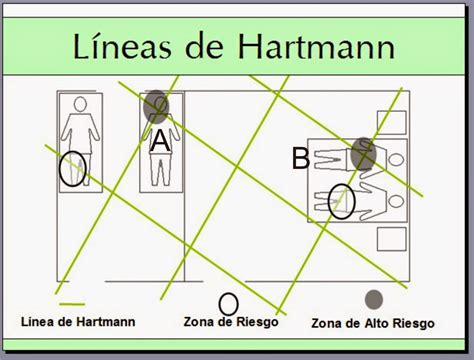 Líneas Hartmann - SAAMA