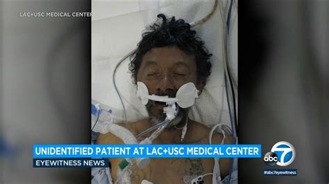 L.A. hospital seeks public’s help in identifying male patient 