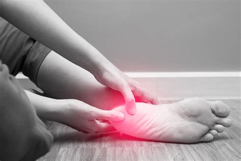 LA FASCITIS PLANTAR Y SU TRATAMIENTO EN FISIOTERAPIA