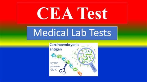 Lab Cea Adalah - coolestguyplanet.net