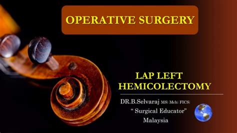 LAP LEFT HEMICOLECTOMY-STEP BY STEP Operative …