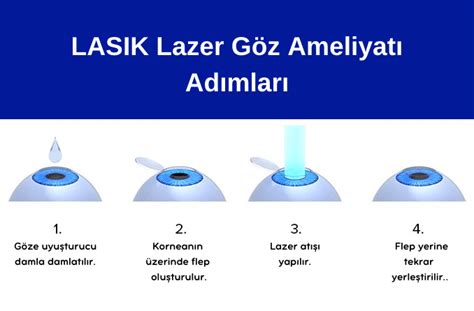 LASIK - wintechmobiles.com