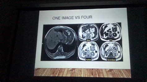 LAVA SEQUENCE MRI - MR-TIP: Database