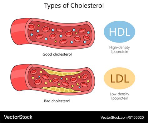 LDL-kolesterol &ndash; Wikipedia