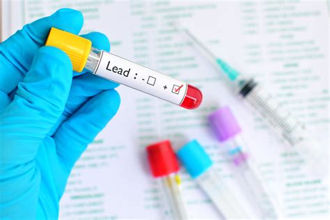 LEAD Tests