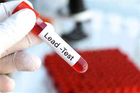 LEAD Tests.pdf