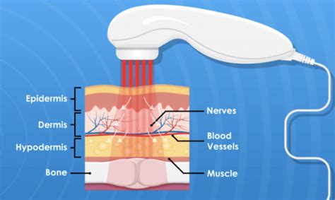 LLLT & PBM Low Level Laser Therapy CPT Billing - Da Vinci Medical