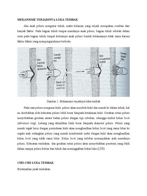 Luka tembak - Wikipedia bahasa Indonesia, ensiklopedia bebas - wintechmobiles.com